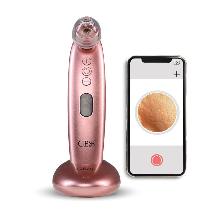 GESS Sleek прибор для вакуумной чистки и микродермабразии лица с микрокамерой и приложением
GESS Sleek прибор для вакуумной чистки и микродермабразии лица с микрокамерой и приложением
