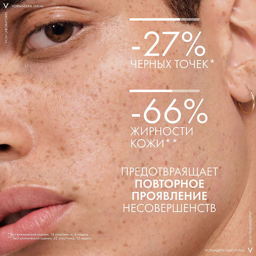 VICHY Пробиотическая обновляющая сыворотка против несовершенств кожи Normaderm Probio-BHA Serum – фото 9