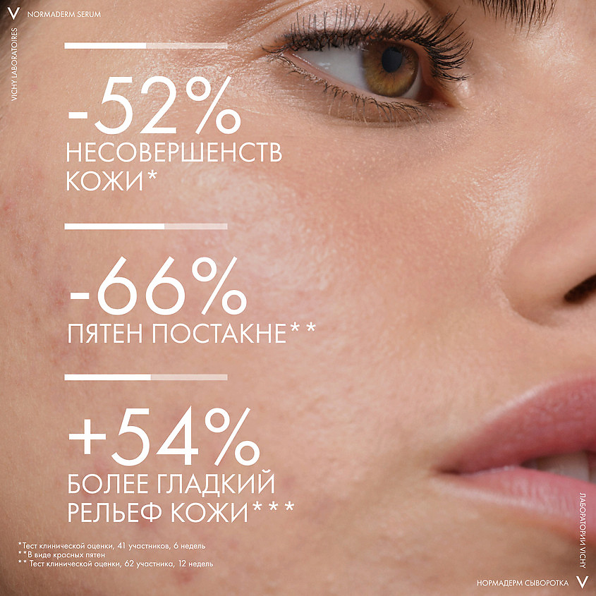 VICHY Пробиотическая обновляющая сыворотка против несовершенств кожи Normaderm Probio-BHA Serum – фото 4