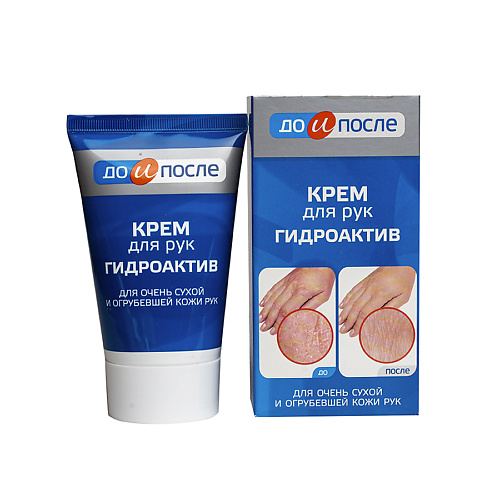 

ДО И ПОСЛЕ Крем для сухой кожи рук Гидроактив 100.0, Крем для сухой кожи рук Гидроактив