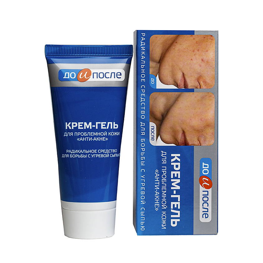 ДО И ПОСЛЕ Крем-гель для проблемной кожи «Анти-Акне» купить по низким ...