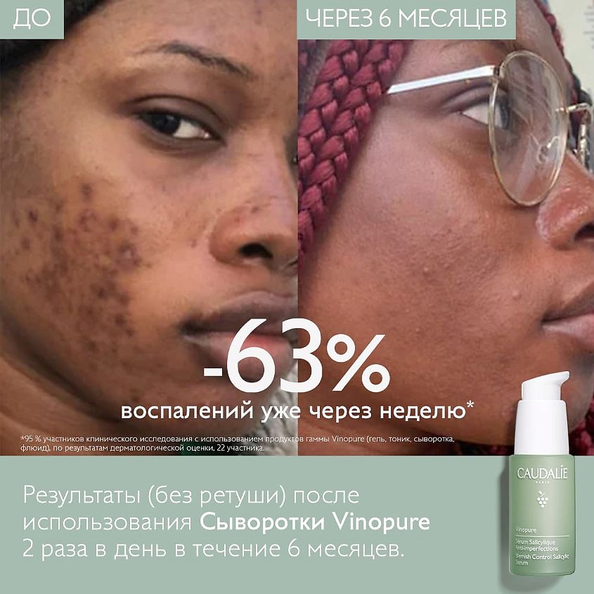 CAUDALIE Сыворотка для для лица для проблемной кожи с салициловой кислотой Vinopure – фото 7