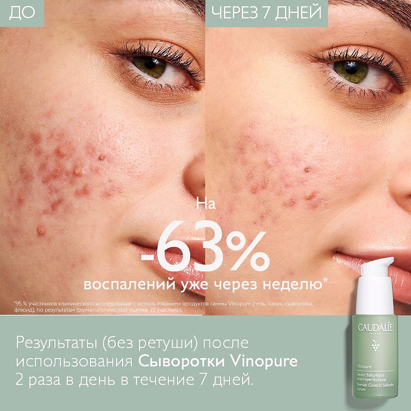 CAUDALIE Сыворотка для для лица для проблемной кожи с салициловой кислотой Vinopure – фото 4