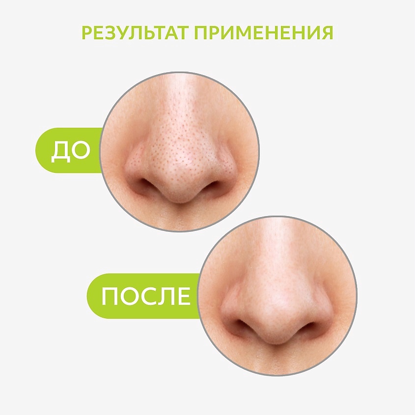 CETTUA Очищающие полоски для носа для удаления черных точек Sticky Pore Patch – фото 4