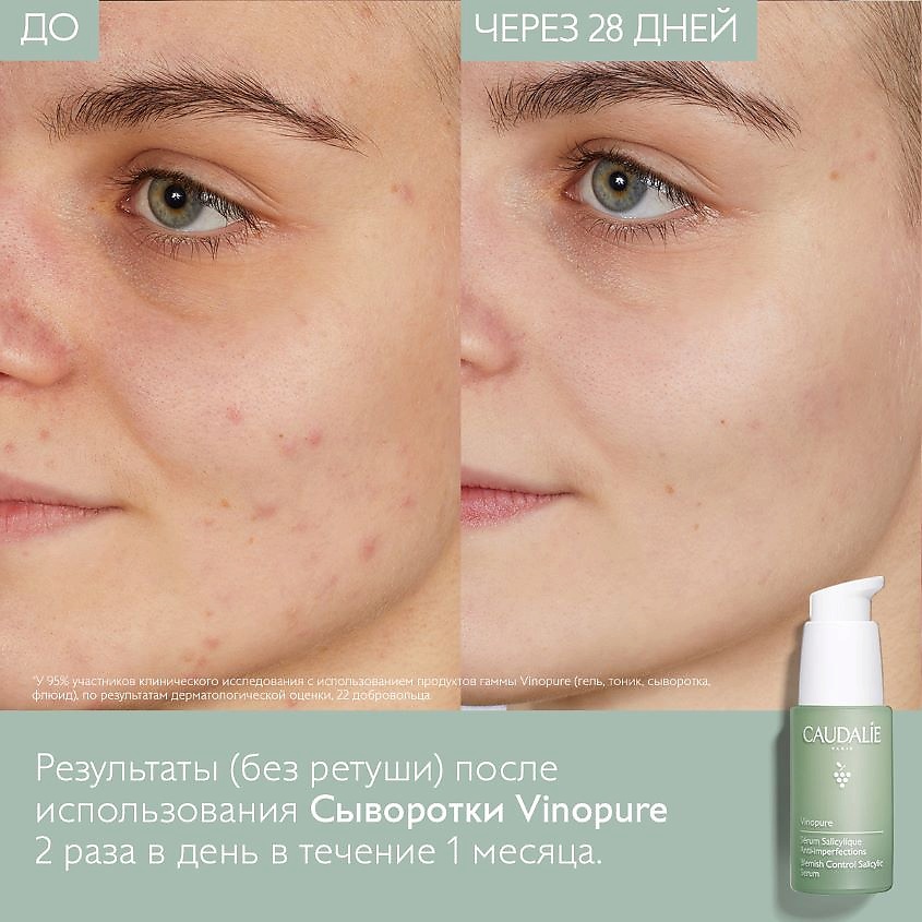 CAUDALIE Сыворотка для для лица для проблемной кожи с салициловой кислотой Vinopure – фото 6
