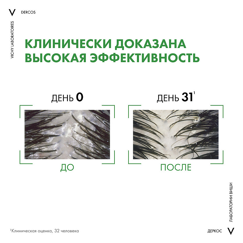 VICHY Шампунь-уход для сухих волос интенсивный Dercos Anti-Dandruff (рефил) – фото 4