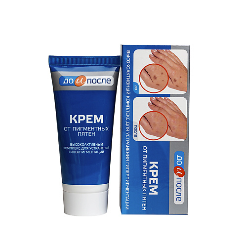 

ДО И ПОСЛЕ Крем от пигментных пятен 50, Крем от пигментных пятен