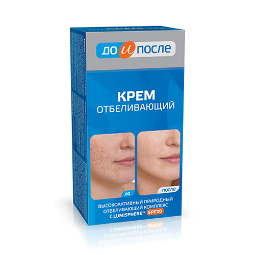 

ДО И ПОСЛЕ Крем Отбеливающий 100, Крем Отбеливающий