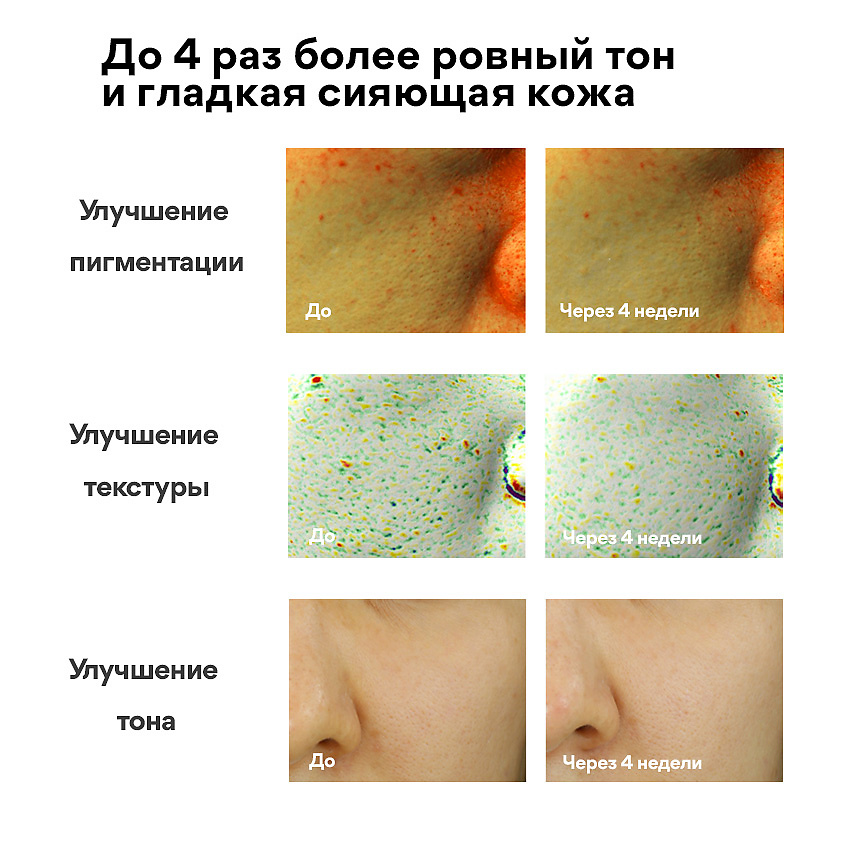 INNISFREE Обновляющая сыворотка с витамином С и энзимами зеленого чая для выравнивания тона кожи Vita C, 30 мл – фото 6