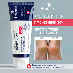 Крем для ног с мочевиной 30% «UREA» против трещин и сухих мозолей