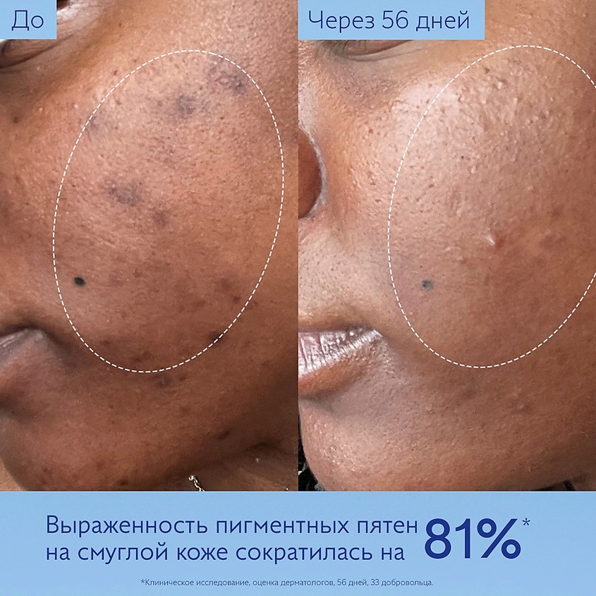 CAUDALIE Сыворотка для лица для сияния выравнивающая тон кожи Vinoperfect – фото 7