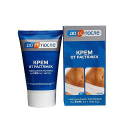Крем от растяжек