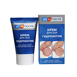 Крем для сухой кожи рук Гидроактив